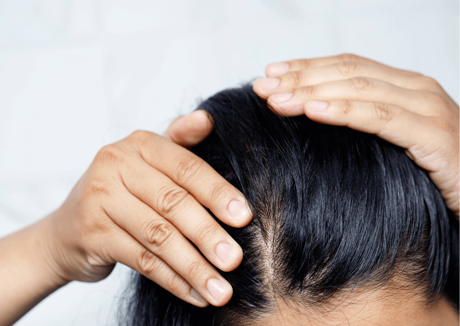 Everything you need to know about alopecia or circular hair loss